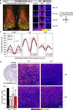 VIP Antibody in Immunohistochemistry (IHC)