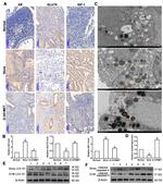 GLUT4 Antibody in Immunohistochemistry (IHC)