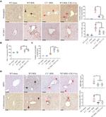 VCAM-1 (CD106) Antibody in Immunohistochemistry (IHC)