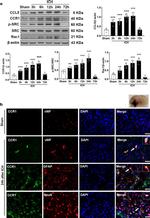 CCR1 Antibody in Western Blot, Immunohistochemistry (WB, IHC)