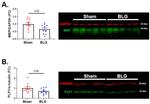 MBP Antibody in Western Blot (WB)