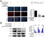 NFkB p65 Antibody in Western Blot (WB)