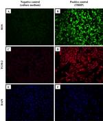 TGM2 Antibody in Immunocytochemistry (ICC/IF)