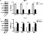 MMP9 Antibody in Western Blot (WB)