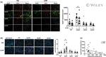 APOE Antibody in Immunohistochemistry (Frozen), Proximity Ligation Assay (PLA) (IHC (F), PLA)