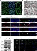 beta Catenin Antibody in Western Blot, Immunohistochemistry (WB, IHC)