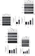 ANP Antibody in Western Blot (WB)