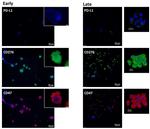 CD274 (PD-L1, B7-H1) Antibody in Immunohistochemistry (Paraffin) (IHC (P))