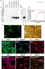 Synaptophysin Antibody in Immunocytochemistry (ICC/IF)