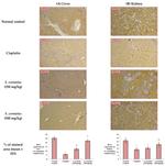 Bcl-2 Antibody in Immunohistochemistry (Paraffin) (IHC (P))