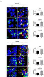 beta Catenin Antibody in Immunocytochemistry (ICC/IF)