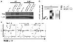 Nod2 Antibody in Western Blot (WB)