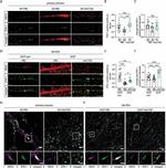 Synapsin 1 Antibody in Immunocytochemistry (ICC/IF)