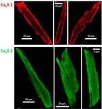 CaV3.2 Antibody in Immunocytochemistry (ICC/IF)