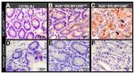 Phospho-SGK1 (Thr256) Antibody in Immunohistochemistry (IHC)