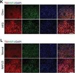 Rabbit IgG (H+L) Cross-Adsorbed Secondary Antibody in Immunohistochemistry (IHC)