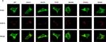 Rabbit IgG (H+L) Highly Cross-Adsorbed Secondary Antibody in Immunocytochemistry (ICC/IF)