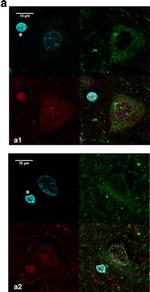 Rabbit IgG (H+L) Cross-Adsorbed Secondary Antibody in Immunohistochemistry (Paraffin) (IHC (P))