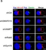 Human IgG (H+L) Cross-Adsorbed Secondary Antibody in Immunocytochemistry (ICC/IF)