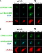 Mouse IgG (H+L) Highly Cross-Adsorbed Secondary Antibody in Immunocytochemistry (ICC/IF)