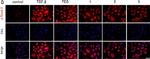 Rabbit IgG (H+L) Cross-Adsorbed Secondary Antibody in Immunocytochemistry (ICC/IF)