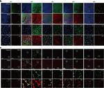 Rabbit IgG (H+L) Cross-Adsorbed Secondary Antibody in Immunohistochemistry (IHC)