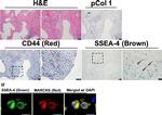 Rabbit IgG (H+L) Cross-Adsorbed Secondary Antibody in Immunohistochemistry (IHC)