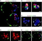 Rabbit IgG (H+L) Cross-Adsorbed Secondary Antibody in Immunohistochemistry (IHC)