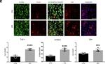 Rabbit IgG (H+L) Highly Cross-Adsorbed Secondary Antibody in Immunocytochemistry (ICC/IF)