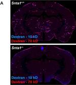 Rabbit IgG (H+L) Highly Cross-Adsorbed Secondary Antibody in Immunohistochemistry (IHC)