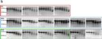 Mouse IgG3 Cross-Adsorbed Secondary Antibody in Western Blot (WB)