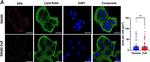 Mouse IgG (H+L) Secondary Antibody in Immunocytochemistry (ICC/IF)