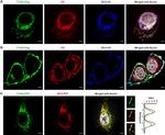 Rabbit IgG (H+L) Highly Cross-Adsorbed Secondary Antibody in Immunocytochemistry (ICC/IF)