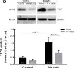 Goat IgG (H+L) Secondary Antibody in Western Blot (WB)