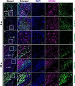 Rabbit IgG (H+L) Highly Cross-Adsorbed Secondary Antibody in Immunohistochemistry (Paraffin) (IHC (P))