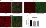 Rabbit IgG (H+L) Cross-Adsorbed Secondary Antibody in Immunohistochemistry (IHC)