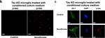 Rabbit IgG (H+L) Cross-Adsorbed Secondary Antibody in Immunohistochemistry (IHC)