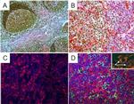 Rabbit IgG (H+L) Highly Cross-Adsorbed Secondary Antibody in Immunohistochemistry (Paraffin) (IHC (P))