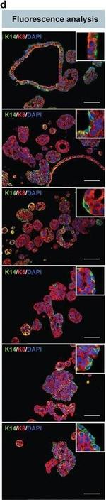 Rabbit IgG (H+L) Highly Cross-Adsorbed Secondary Antibody in Immunohistochemistry (Paraffin) (IHC (P))