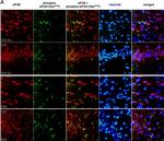 Mouse IgG (H+L) Highly Cross-Adsorbed Secondary Antibody in Immunohistochemistry (IHC)