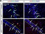 Rabbit IgG (H+L) Highly Cross-Adsorbed Secondary Antibody in Immunohistochemistry (IHC)