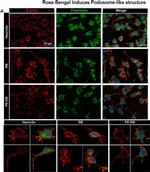 Rabbit IgG (H+L) Highly Cross-Adsorbed Secondary Antibody in Immunocytochemistry (ICC/IF)