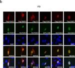 Rabbit IgG (H+L) Highly Cross-Adsorbed Secondary Antibody in Immunocytochemistry (ICC/IF)