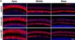 Rabbit IgG (H+L) Highly Cross-Adsorbed Secondary Antibody in Immunohistochemistry (IHC)