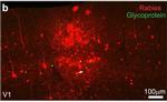 Rabbit IgG (H+L) Highly Cross-Adsorbed Secondary Antibody in Immunohistochemistry (IHC)