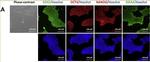 Rabbit IgG (H+L) Highly Cross-Adsorbed Secondary Antibody in Immunocytochemistry (ICC/IF)