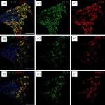 Rabbit IgG (H+L) Highly Cross-Adsorbed Secondary Antibody in Immunohistochemistry (IHC)