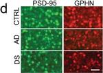 Rabbit IgG (H+L) Highly Cross-Adsorbed Secondary Antibody in Immunohistochemistry (IHC)