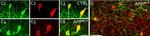 Rabbit IgG (H+L) Highly Cross-Adsorbed Secondary Antibody in Immunohistochemistry (IHC)