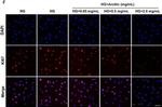 Rabbit IgG (H+L) Highly Cross-Adsorbed Secondary Antibody in Immunocytochemistry (ICC/IF)